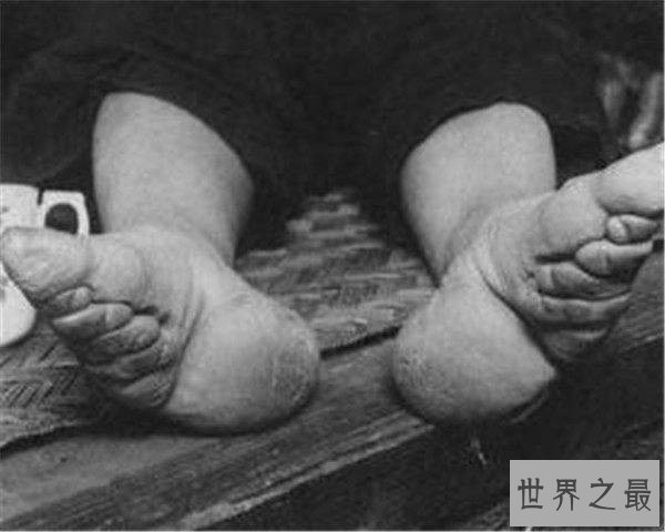 中国史上第一个裹小脚的女人,揭露近千年的畸形美
