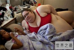 罗莎莉·布拉德福德堪称最胖女人，成功减掉454公斤