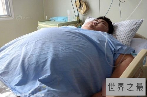 中国第一胖孙亮离世，目前是邓桂梁(520斤)