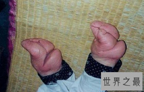 中国第一个缠足的女人,祸害中国千年女性