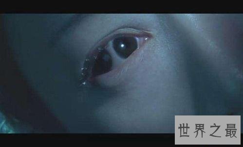 世界十二大最恐怖的怪病,世界上真有狼人症!