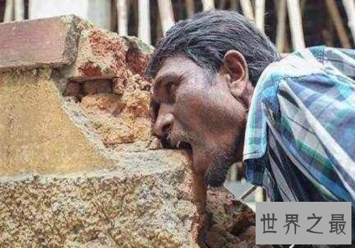 世界十二大最恐怖的怪病,世界上真有狼人症!