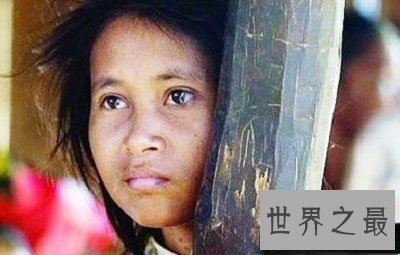 世界十大兽孩最详介绍,他们的童年经历你无法想象!