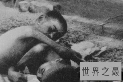 世界十大兽孩最详介绍,他们的童年经历你无法想象!