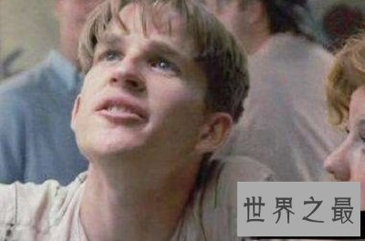 世界十大兽孩最详介绍,他们的童年经历你无法想象!