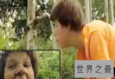 世界十大兽孩最详介绍,他们的童年经历你无法想象!