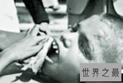 世界十大兽孩最详介绍,他们的童年经历你无法想象!