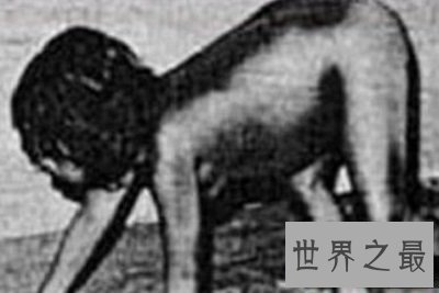 世界十大兽孩最详介绍,他们的童年经历你无法想象!