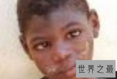 世界十大兽孩最详介绍,他们的童年经历你无法想象!