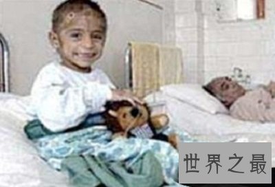 世界十大兽孩最详介绍,他们的童年经历你无法想象!