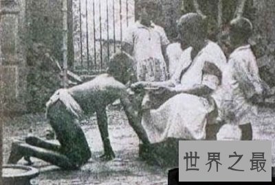 世界十大兽孩最详介绍,他们的童年经历你无法想象!