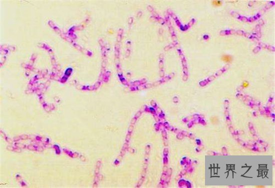 世界上最危险的10种细菌,梅毒高居榜首!