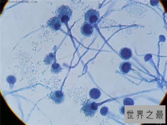 世界上最危险的10种细菌,梅毒高居榜首!