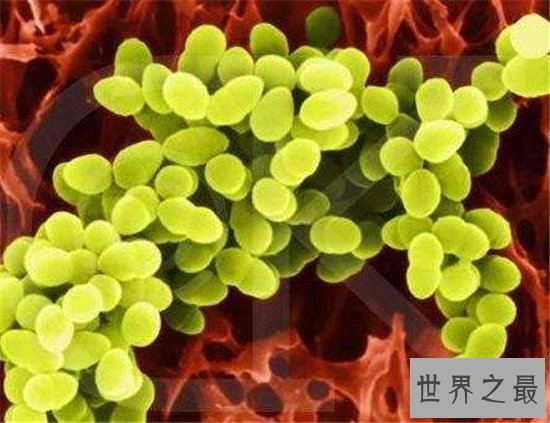 世界上最危险的10种细菌,梅毒高居榜首!