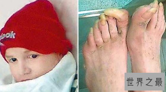 世界十大兽孩，被深山野兽养大的人类孩子