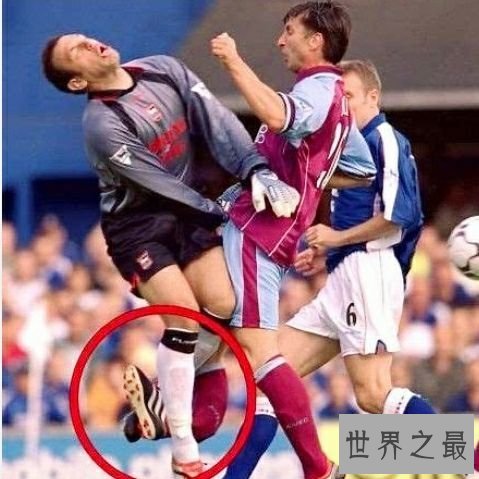 足坛前十名最严重的伤病，多少优秀的球员由于伤病离开了赛场。