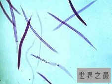 世界上十大恶心的寄生虫，大家吃饭的时候一定不要看会吐的。