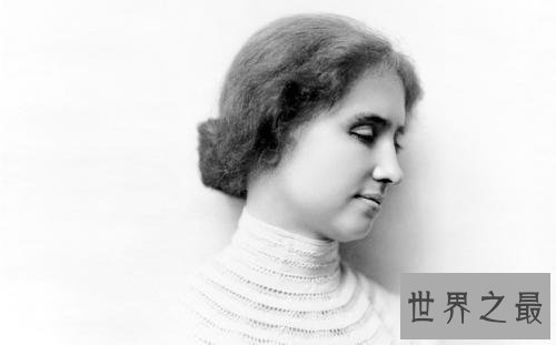 世界上最著名的十大残疾名人,值得所有人学习。