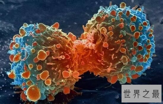 世界十大恐怖病毒排行榜，让人听了名字就害怕。