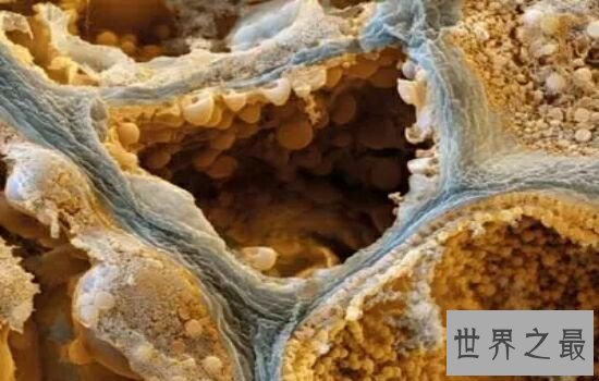 世界十大恐怖病毒排行榜，让人听了名字就害怕。