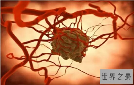 世界十大恐怖病毒排行榜，让人听了名字就害怕。