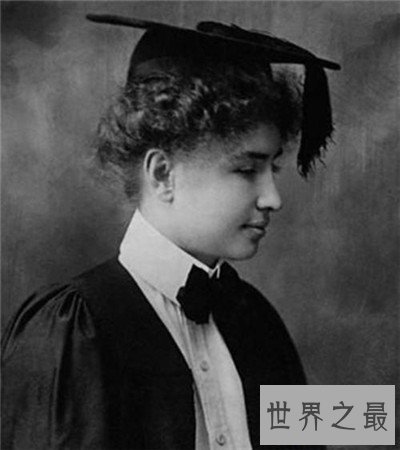 史上十大最伟大的残疾人，他甚至还失去了自己的四肢