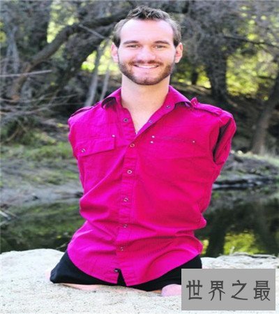 史上十大最伟大的残疾人，他甚至还失去了自己的四肢