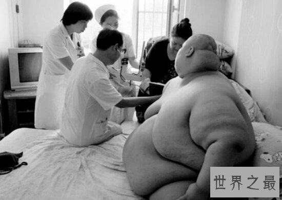十个世界上最重的人 乔恩·布劳尔最胖1257斤!出门靠抬