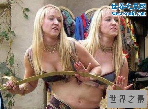 盘点人类十大怪胎，其中一个长了四条腿(怪胎图片)