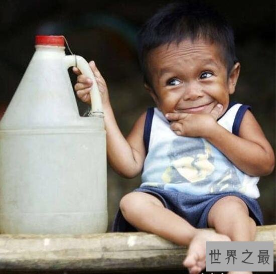 世界十大袖珍人盘点，最矮的人钱德拉只有54cm