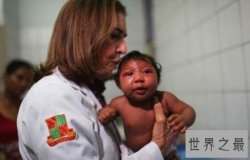 人类历史上最可怕的十大病毒，天花病毒死了1.5亿人