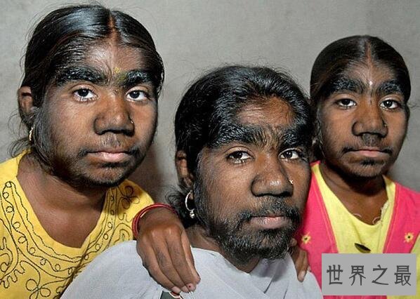 世界十大兽孩,那些被野兽养大的吃人孩子