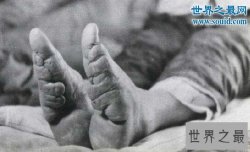 世界十大恐怖习俗，中国缠足太监最残忍可怕