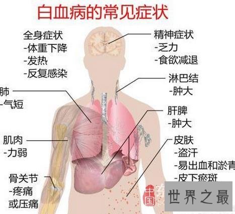 盘点世界五大绝症，如不解决恐毁灭人类