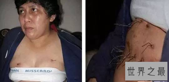 世界人类史上十大怪胎，女童如外星人