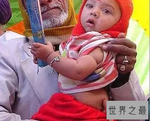 世界人类史上十大怪胎，女童如外星人