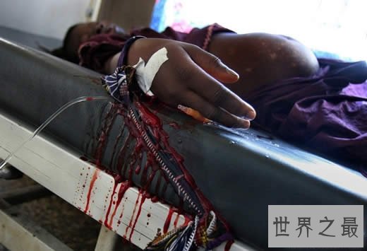 最不适合女性生存的10个国家,残割生殖器(图)