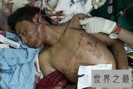 全国十大暴力城市大多以暴力拆迁出名 暴力执法的背后究竟有何依靠