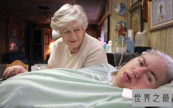 世界上昏迷时间最长的人,整整是昏迷了42年