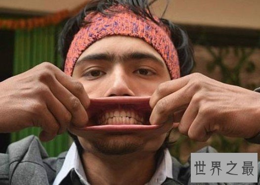 世界第一大嘴,嘴巴里塞入了138根铅笔