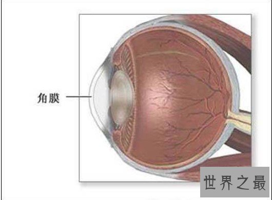世界第一例人工干细胞培养眼角膜移植成功,40岁女性恢复视力