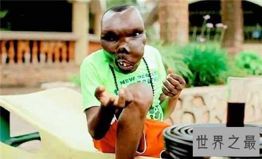 最丑男人丑陋外表无法想象，参加选秀节目成冠军