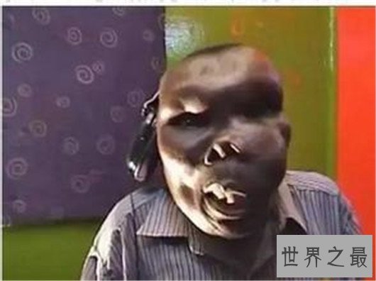 最丑男人丑陋外表无法想象，参加选秀节目成冠军