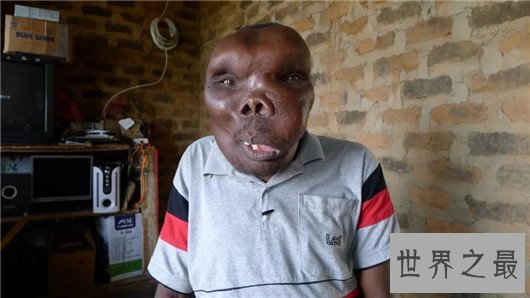 最丑男人丑陋外表无法想象，参加选秀节目成冠军