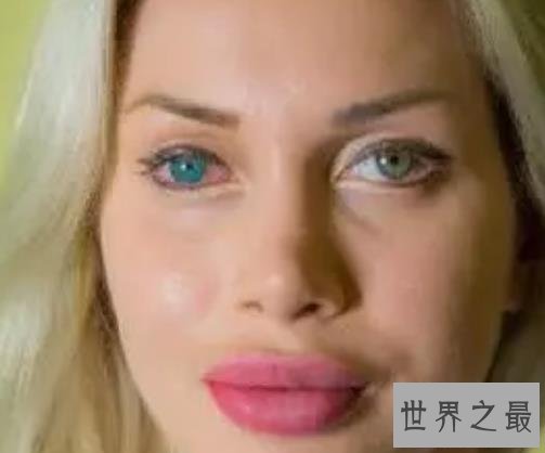 世界最夸张的整容美女，皮埃·福克斯花七十七万美元整容！
