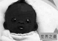 看世界上最黑的孩子，世界史无前例的黑你意想不到