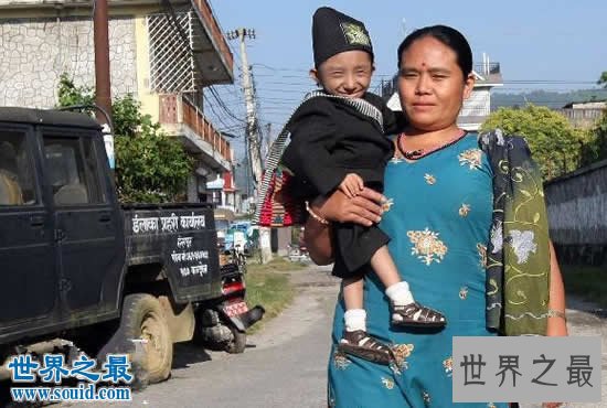 世界上体重最轻的人,18岁少年体重仅11斤(图)