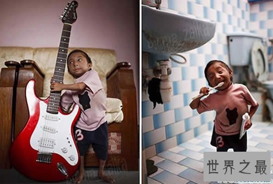 世界上体重最轻的人,18岁少年体重仅11斤(图)