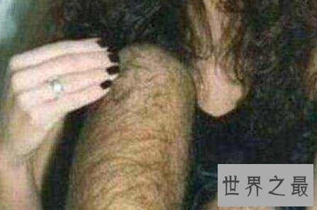 艾米丽苏珊是世界上体毛最长的女人 她现在竟过着这样的生活