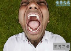 世界上牙齿最多的人，比正常人多9颗(图)